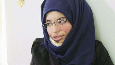 "العنود شريان" ضحية زواج الأطفال في اليمن تروي قصتها