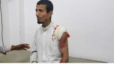 استهداف شاب يمني برصاص قناص حوثي