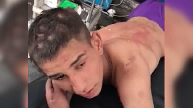 الكاظمي يأمر ببدء تحقيق فوري بحادثة الاعتداء على مراهق عراقي