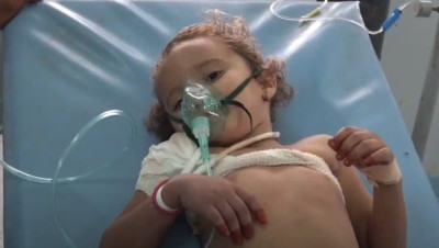 عشية العيد.. قناص حوثي يصيب طفلة يمنية (فيديو)