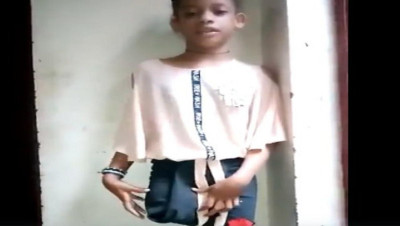 بالفيديو.. طفلة يمنية فقدت ساقها بقصف حوثي تشكو للمبعوث الأممي