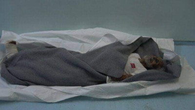 بالفيديو.. سبعيني يفارق الحياة في قصف لميليشيات الحوثي