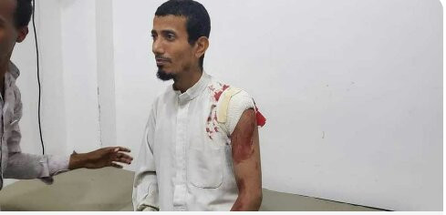 استهداف شاب يمني برصاص قناص حوثي